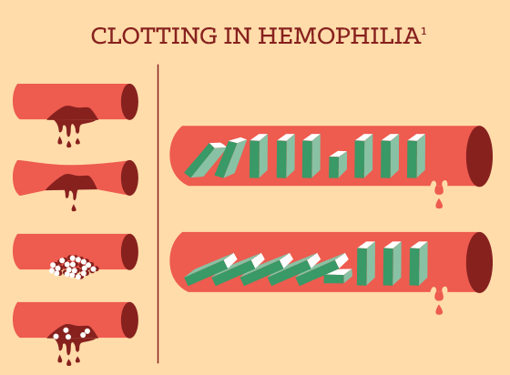 Hempohilia info graphic